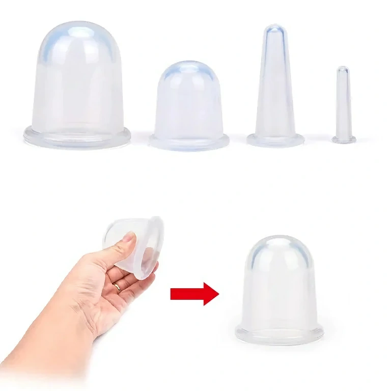 Terapia cu ventuze pentru reducerea grăsimii și a celulitei